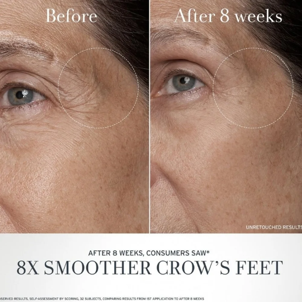 CLEARANCE! Fresh Black Tea Advanced Age Renewal Eye Cream, 15ml, NIB - Picture 5 of 8